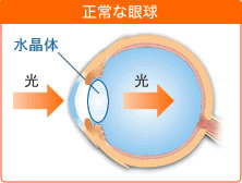 正常な眼球